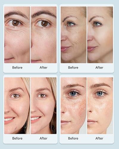 Sara Light™ LED Face Mask ..