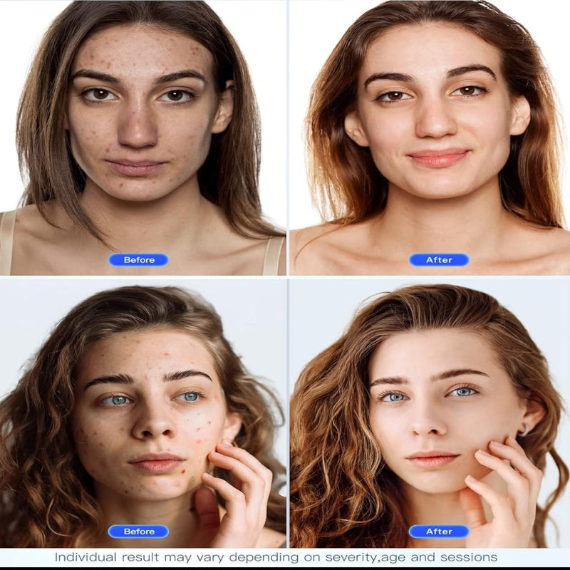Sara Light™ LED Face Mask ..